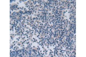IHC-P analysis of lymph node tissue, with DAB staining. (NCR1 抗体  (AA 17-211))