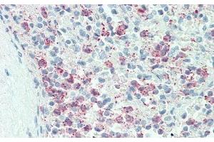 Detection of IL17RC in Human Spleen Tissue using Polyclonal Antibody to Interleukin 17 Receptor C (IL17RC) (IL17RC 抗体  (AA 73-330))