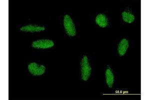 Immunofluorescence of purified MaxPab antibody to ZNF383 on HepG2 cell. (ZNF383 抗体  (AA 1-475))