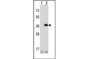 Western blot analysis of PEX16 (arrow) using Peroxin 16 / PEX16 Antibody (Center) Cat.