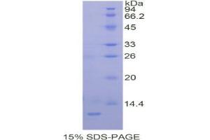 SDS-PAGE analysis of Human PRAME Protein. (PRAME 蛋白)