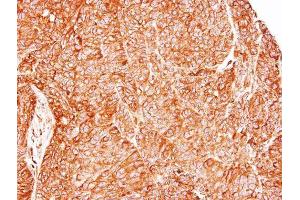 IHC-P Image Immunohistochemical analysis of paraffin-embedded DLD1 xenograft, using TC21, antibody at 1:500 dilution. (RRAS2 抗体  (Center))