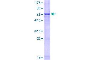 Image no. 1 for Leucine-Rich alpha-2 Glycoprotein 1 (LRG1) (AA 37-347) protein (GST tag) (ABIN1309718)