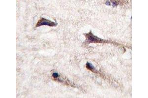 IHC analysis of FFPE human brain tissue stained with PKC beta 2 antibody (PKC beta 抗体  (AA 642-673))