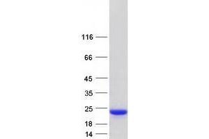 Validation with Western Blot