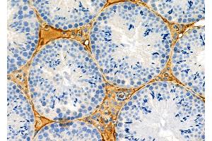 ABIN6263344 and ABIN6273141 at 1/100 staining Mouse testis tissue by IHC-P.