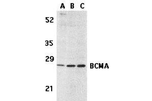 Western Blotting (WB) image for anti-Tumor Necrosis Factor Receptor Superfamily, Member 17 (TNFRSF17) (C-Term) antibody (ABIN1030288) (BCMA 抗体  (C-Term))