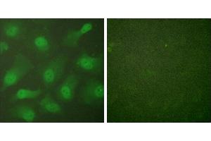 Forskolin + -Immunofluorescence analysis of HeLa cells, treated with Forskolin (40nM, 30mins), using CSantibody. (Exportin 2 抗体)