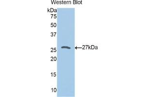 Western blot analysis of the recombinant protein. (Peroxiredoxin 3 抗体  (AA 5-233))