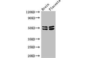 Western Blot Positive WB detected in: Mouse brain tissue, Human placenta tissue All lanes: ADRB1 antibody at 3 μg/mL Secondary Goat polyclonal to rabbit IgG at 1/50000 dilution Predicted band size: 52 kDa Observed band size: 52, 48 kDa (ADRB1 抗体  (AA 401-477))