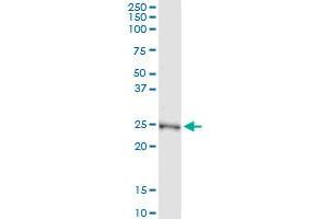 Immunoprecipitation of NME5 transfected lysate using anti-NME5 MaxPab rabbit polyclonal antibody and Protein A Magnetic Bead , and immunoblotted with NME5 purified MaxPab mouse polyclonal antibody (B01P) . (NME5 抗体  (AA 1-212))