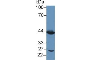 Western Blotting (WB) image for anti-Tachykinin Receptor 2 (TACR2) (AA 92-290) antibody (ABIN7432214)