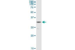 Western Blotting (WB) image for anti-Myeloid Differentiation Primary Response Gene (88) (MYD88) (AA 1-296) antibody (ABIN950147)