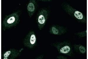 Immunofluorescence staining of human endothelial cells. (CENPF 抗体  (AA 209-381))