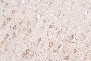 Immunohistochemistry of paraffin-embedded rat brain using CD274 Antibody (ABIN6291806) at dilution of 1:100 (40x lens). (PD-L1 抗体)
