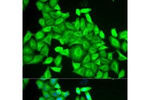 Immunofluorescence analysis of HeLa cells using RAB6A Polyclonal Antibody (RAB6A 抗体)
