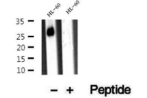 Western blot analysis of extracts of HL-60 cells, using ARHGDIB antibody. (ARHGDIB 抗体  (N-Term))