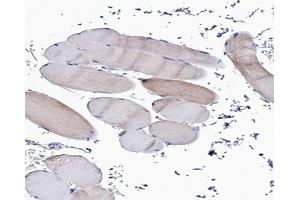 Immunohistochemistry (IHC) image for anti-Collagen, Type V, alpha 1 (COL5A1) (N-Term) antibody (ABIN6260948)