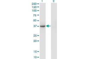 Western Blotting (WB) image for anti-SGT1, Suppressor of G2 Allele of SKP1 (SUGT1) (AA 151-260) antibody (ABIN524315)