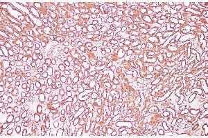 Immunohistochemistry of paraffin-embedded Human kidney using CDK4 Polyclonal Antibody at dilution of 1:100 (CDK4 抗体)