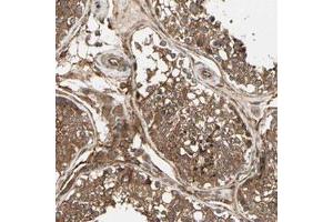 Immunohistochemical staining (Formalin-fixed paraffin-embedded sections) of human testis with FKBP15 polyclonal antibody  shows strong cytoplasmic positivity in cells in seminiferous ducts and Leydig cells. (FKBP15 抗体)