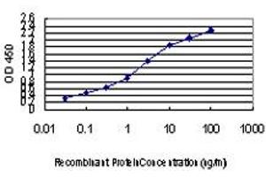 Detection limit for recombinant GST tagged PIK3R4 is approximately 0. (PIK3R4 抗体  (AA 1259-1358))
