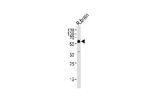 Western Blotting (WB) image for anti-Glutamate Decarboxylase 2 (Pancreatic Islets and Brain, 65kDa) (GAD2) (AA 109-138) antibody (ABIN655070)