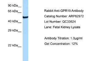 Western Blotting (WB) image for anti-G Protein-Coupled Receptor 19 (GPR19) (C-Term) antibody (ABIN2789316)