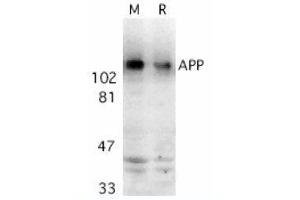 Image no. 1 for anti-Amyloid beta (A4) Precursor Protein (APP) (AA 737-751) antibody (ABIN319013) (APP 抗体  (AA 737-751))