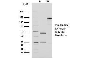 SDS-PAGE Analysis Purified PAPP-A Mouse Monoclonal Antibody (PAPPA/2718). (PAPPA 抗体  (AA 351-523))