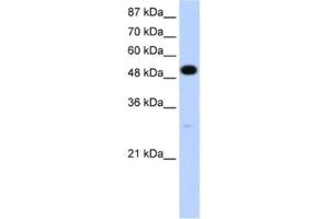 Western Blotting (WB) image for anti-Neuro-Oncological Ventral Antigen 2 (NOVA2) antibody (ABIN2462124) (NOVA2 抗体)