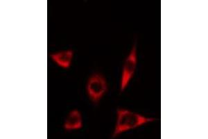 Immunofluorescence (fixed cells) (IF/ICC) image for anti-Cytochrome P450, Family 17, Subfamily A, Polypeptide 1 (CYP17A1) (Internal Region) antibody (ABIN6258050)