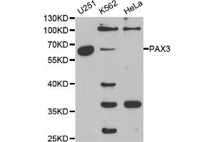Western blot analysis of extracts of various cell lines, using PAX3 antibody (ABIN5970834) at 1/1000 dilution. (Paired Box 3 抗体)