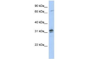 H1FOO antibody used at 1 ug/ml to detect target protein. (H1FOO 抗体  (N-Term))