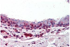 Human Lung, Respiratory Epithelium (formalin-fixed, paraffin-embedded) stained with PRMT1 antibody ABIN462306 followed by biotinylated goat anti-rabbit IgG secondary antibody ABIN481713, alkaline phosphatase-streptavidin and chromogen. (PRMT1 抗体  (AA 317-346))