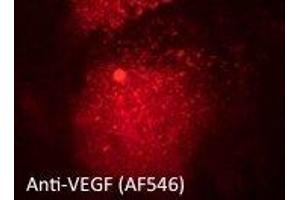 Immunostaining of primary RPE cells using VEGFAAb at 1/50 dilution, (VEGFA 抗体  (Isoform 6))