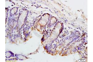 Formalin-fixed and mouse colon tissue labeled with Anti-PAX9 Polyclonal Antibody, Unconjugated (ABIN737691) at 1:200 followed by conjugation to the secondary antibody and DAB staining (PAX9 抗体  (AA 271-341))
