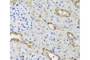 Immunohistochemistry of paraffin-embedded Rat kidney using HK3 Polyclonal Antibody at dilution of 1:100 (40x lens). (HK3 抗体)