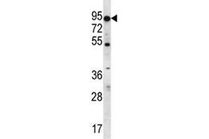 ABCD2 antibody western blot analysis in K562 lysate. (CCL17 抗体  (AA 553-582))
