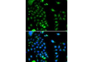 Immunofluorescence analysis of MCF-7 cells using UBE2J2 antibody. (UBE2J2 抗体)