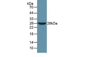 Western blot analysis of recombinant Mouse WARS. (WARS 抗体  (AA 29-195))