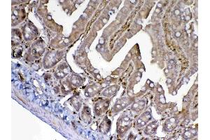 IHC analysis of ADA using anti-ADA antibody . (ADA 抗体  (AA 2-238))
