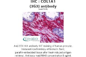 Image no. 2 for anti-Collagen, Type I, alpha 1 (COL1A1) (AA 1021-1108) antibody (ABIN1723789) (COL1A1 抗体  (AA 1021-1108))