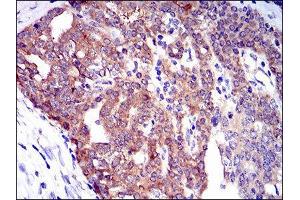 Immunohistochemistry (IHC) image for anti-Twinfilin, Actin-Binding Protein 1 (TWF1) (AA 335-384) antibody (ABIN1846307) (TWF1 抗体  (AA 335-384))