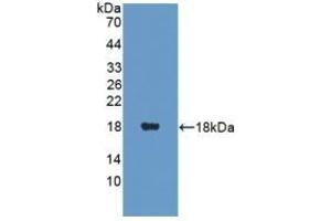 Detection of Recombinant PANK4, Human using Polyclonal Antibody to Pantothenate Kinase 4 (PANK4) (PANK4 抗体  (AA 639-773))
