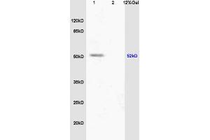 L1 human colon carcinoma lysate L2 mouse embryo lysates probed with Anti phospho-PPAR alpha(Ser12) Polyclonal Antibody, Unconjugated (ABIN753163) at 1:200 overnight at 4 °C. (PPARA 抗体  (pSer12))