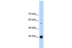 WB Suggested Anti-HNRPAB Antibody Titration:  1. (HNRNPAB 抗体  (C-Term))