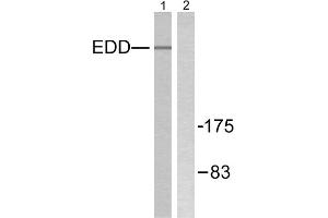 Western blot analysis of extracts from A549 cells, using EDD antibody. (UBR5 抗体  (N-Term))