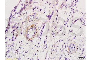 Formalin-fixed and skin of rat foot tissue labeled with Anti-ADRB1 Polyclonal Antibody, Unconjugated (ABIN669351) at 1:200 followed by conjugation to the secondary antibody and DAB staining (ADRB1 抗体  (AA 181-250))