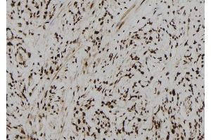 ABIN6261007 and ABIN6273104 at 1/100 staining Human gastric tissue by IHC-P. (CPSF4 抗体  (C-Term))